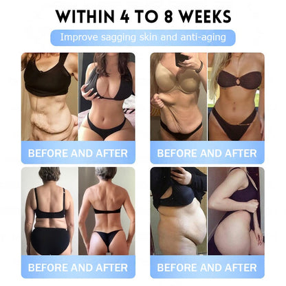 FDA Official Store | Myo Clinic GLP-1 Slim & Firm Nano Microneedle Patch with Collagen, Turmeric & Matrixyl 3000丨Obesity, Cardiovascular Disease, Diabetes, Sleep Apnea, Joint Problems and More