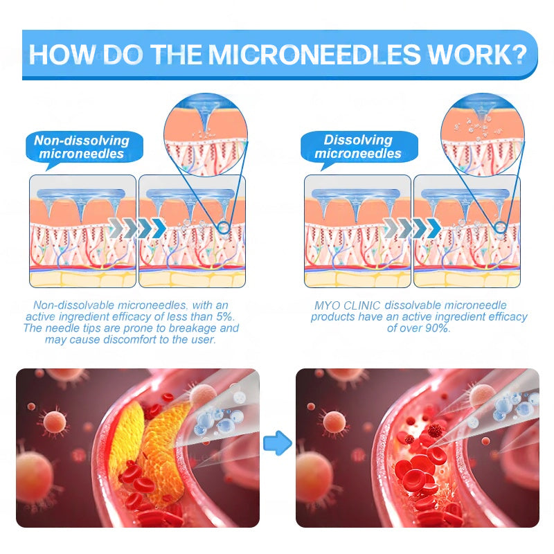 FDA Official Store | Myo Clinic GLP-1 Slim & Firm Nano Microneedle Patch with Collagen, Turmeric & Matrixyl 3000丨Obesity, Cardiovascular Disease, Diabetes, Sleep Apnea, Joint Problems and More